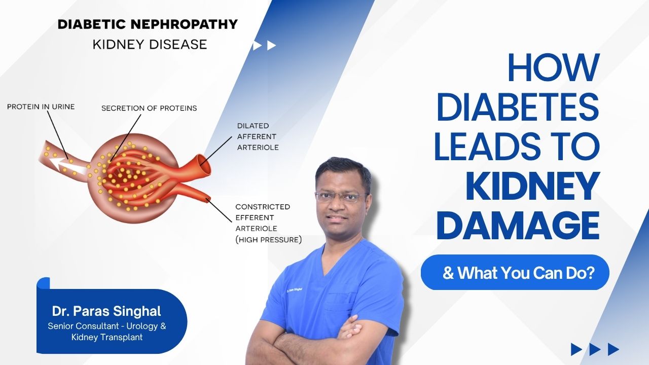 How Diabetes Damages Your Kidneys